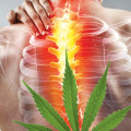 Can Medical Marijuana Help Relieve Back Pain?